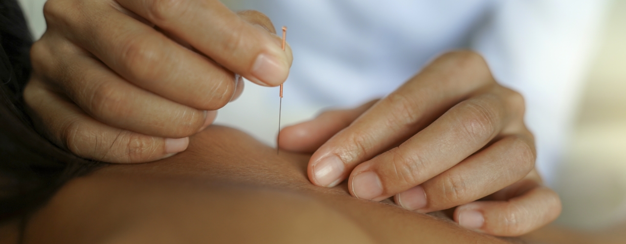 physical-therapy-clinic-dry-needling-connecticut-physical-therapy-specialist-granby-west-hartford-glastonbury-ct