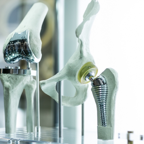 Physical therapy clinic specializing in total joint replacement rehab at Connecticut Physical Therapy Specialist